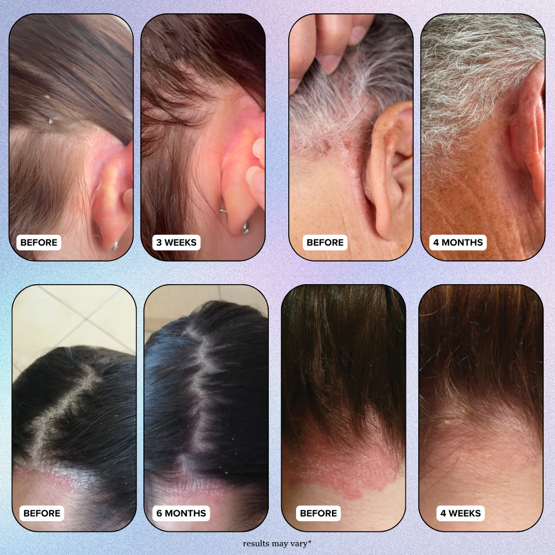 Scalp Reset Starter Kit