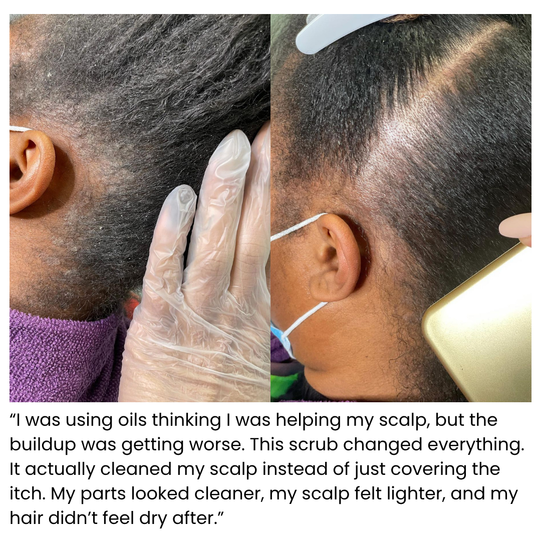 Revive + Restore Scalp Scrub For Textured Hair