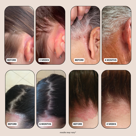 Revive and Restore Scalp Scrub