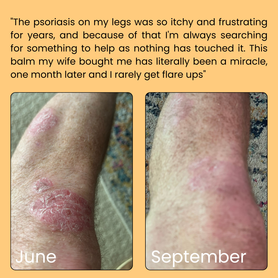 Advanced Skin Repair Balm