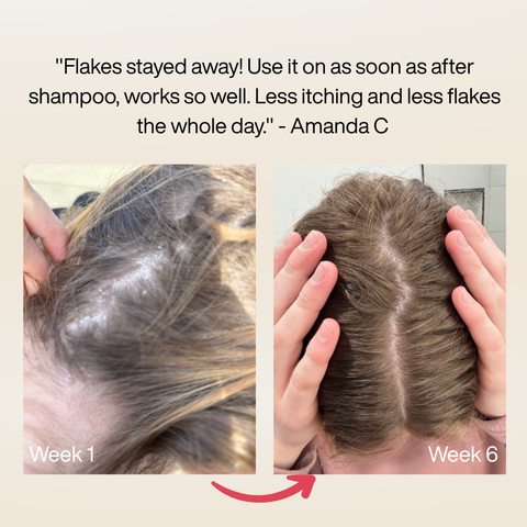 Scalp Serum New
