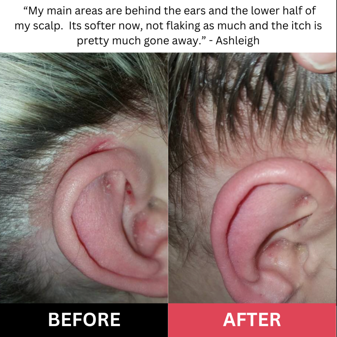 Scalp Scrub